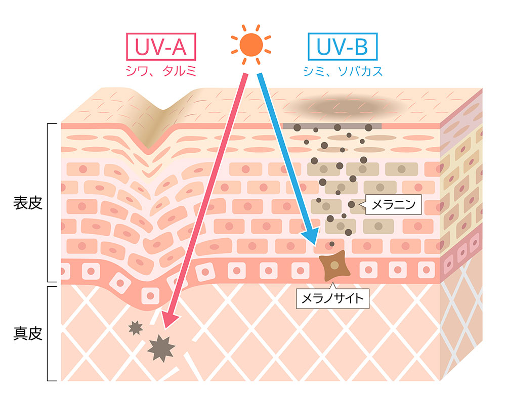 UV波の画像